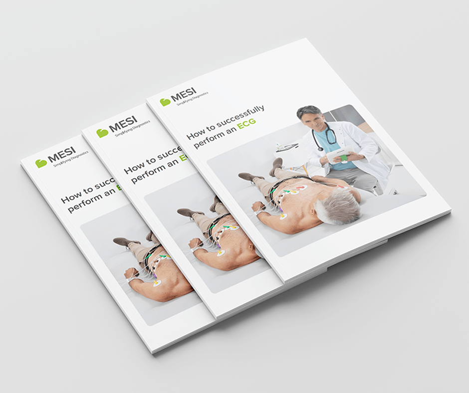 E-book: Hoe voer je succesvol een ECG uit?